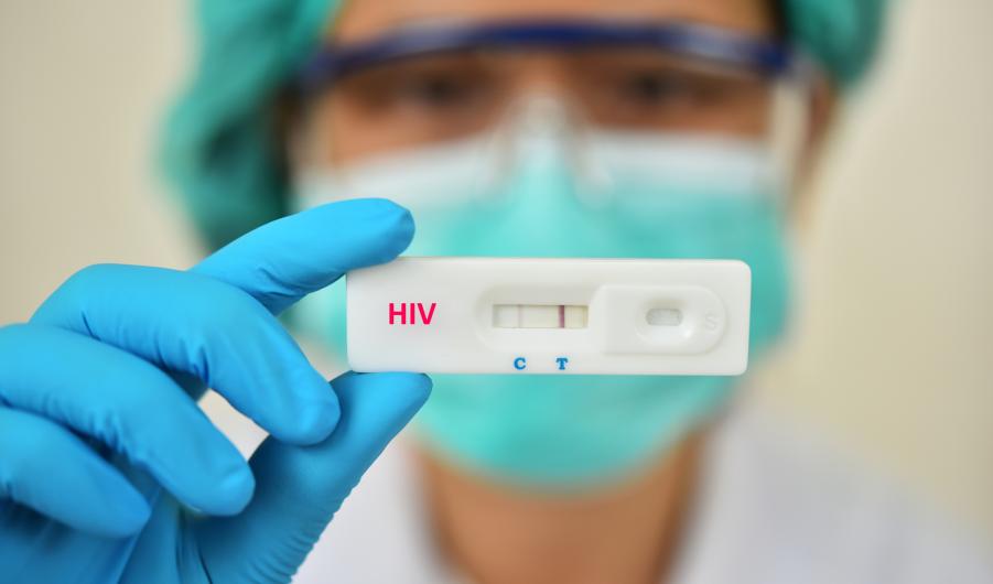 HIV test